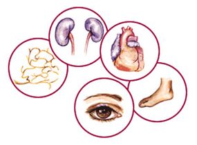 Órganos aos que complicacións da diabetes mellitus